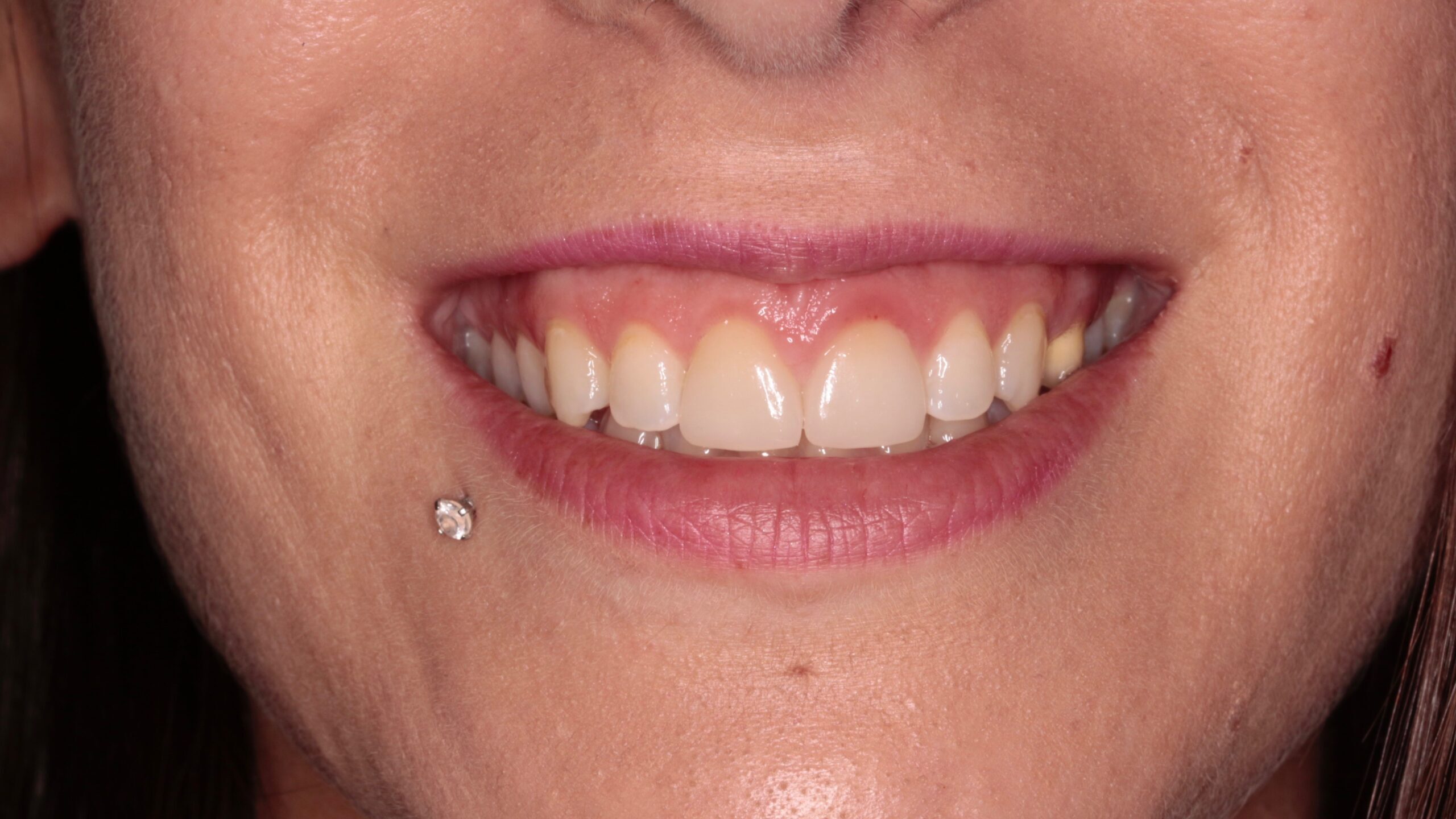 Problemas dentales - Dra. Elena Martínez Madero