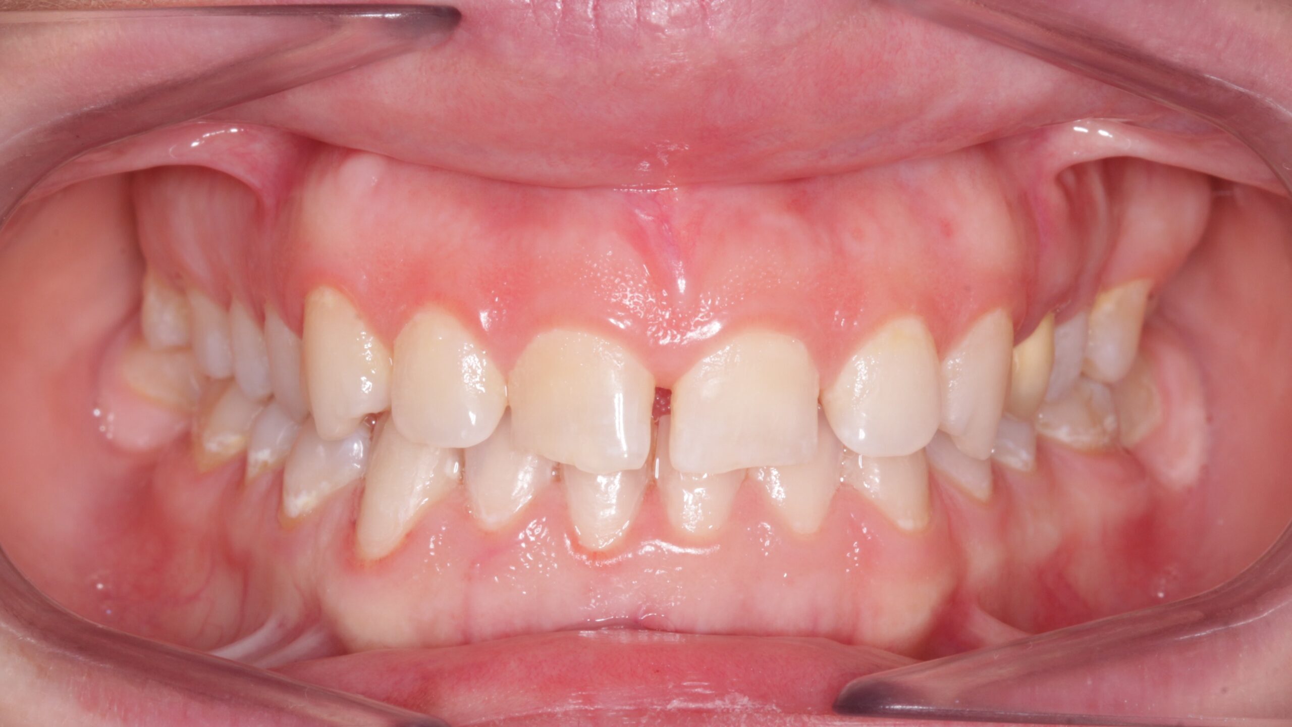 Problemas dentales - Dra. Elena Martínez Madero