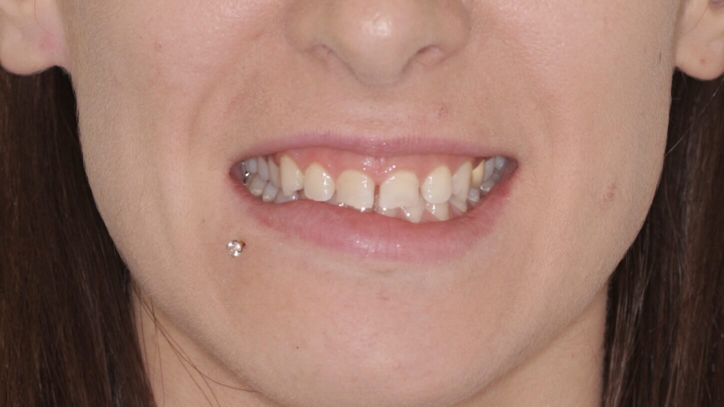 Problemas dentales - Dra. Elena Martínez Madero